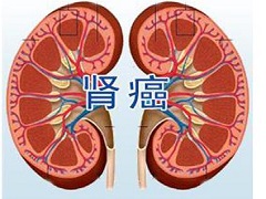 客服微信